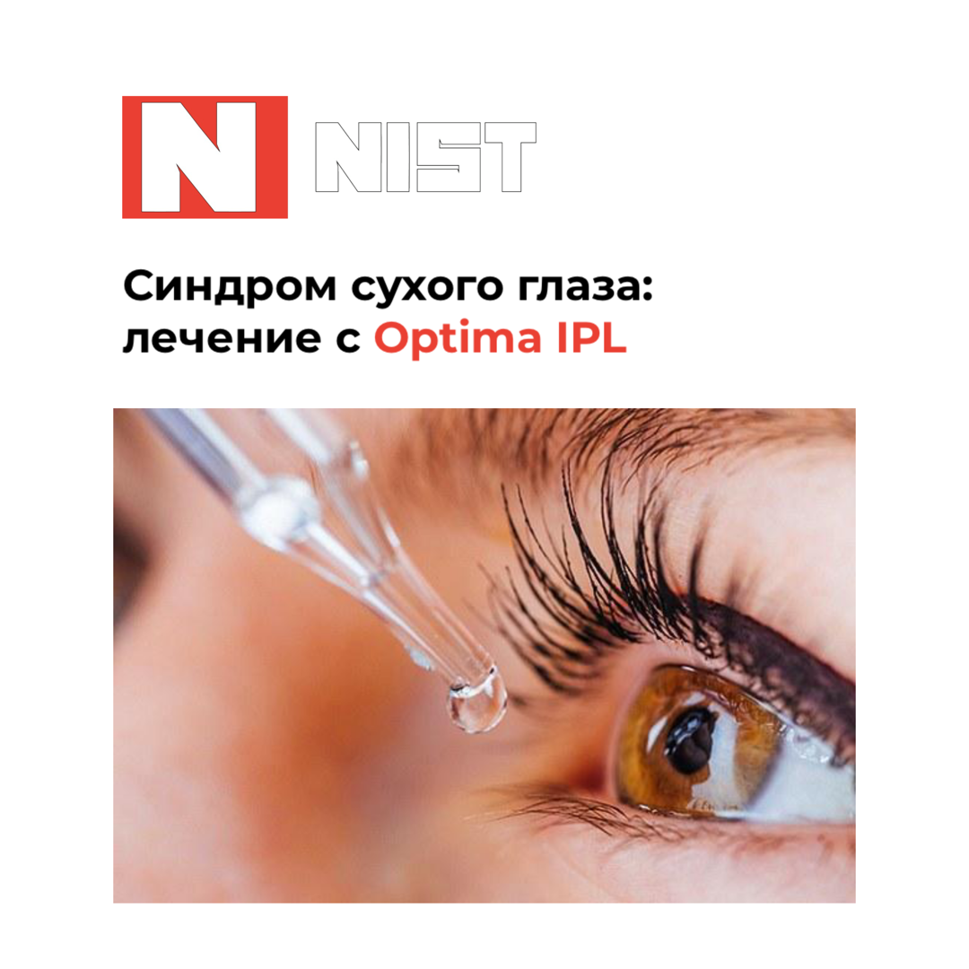 Синдром сухого глаза: лечение с Optima IPL